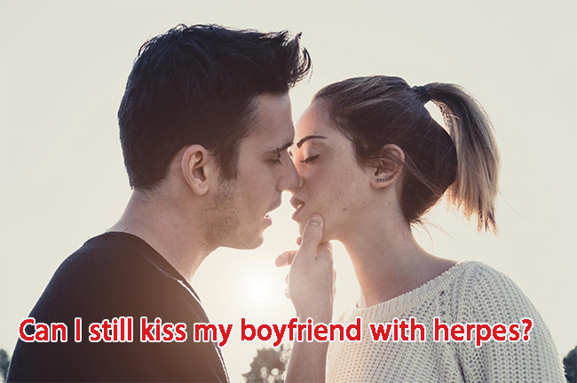 Can I still kiss my boyfriend with herpes?