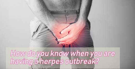 know when your having a herpes outbreak